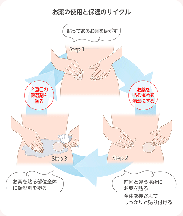 Step1 貼ってあるお薬をはがす お薬を貼る場所を清潔にする Step2 前回と違う場所にお薬を貼る 全体を押さえてしっかりと貼り付ける Step3 お薬を貼る部位全体に保湿剤を塗る 2回目の保湿剤を塗る