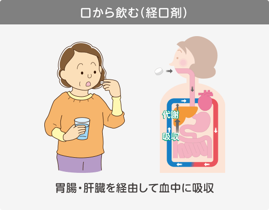 口から飲む（経口剤）胃腸・肝臓を経由して血中に吸収