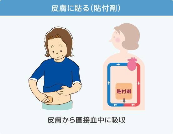 皮膚に貼る（貼付剤）皮膚から直接血中に吸収